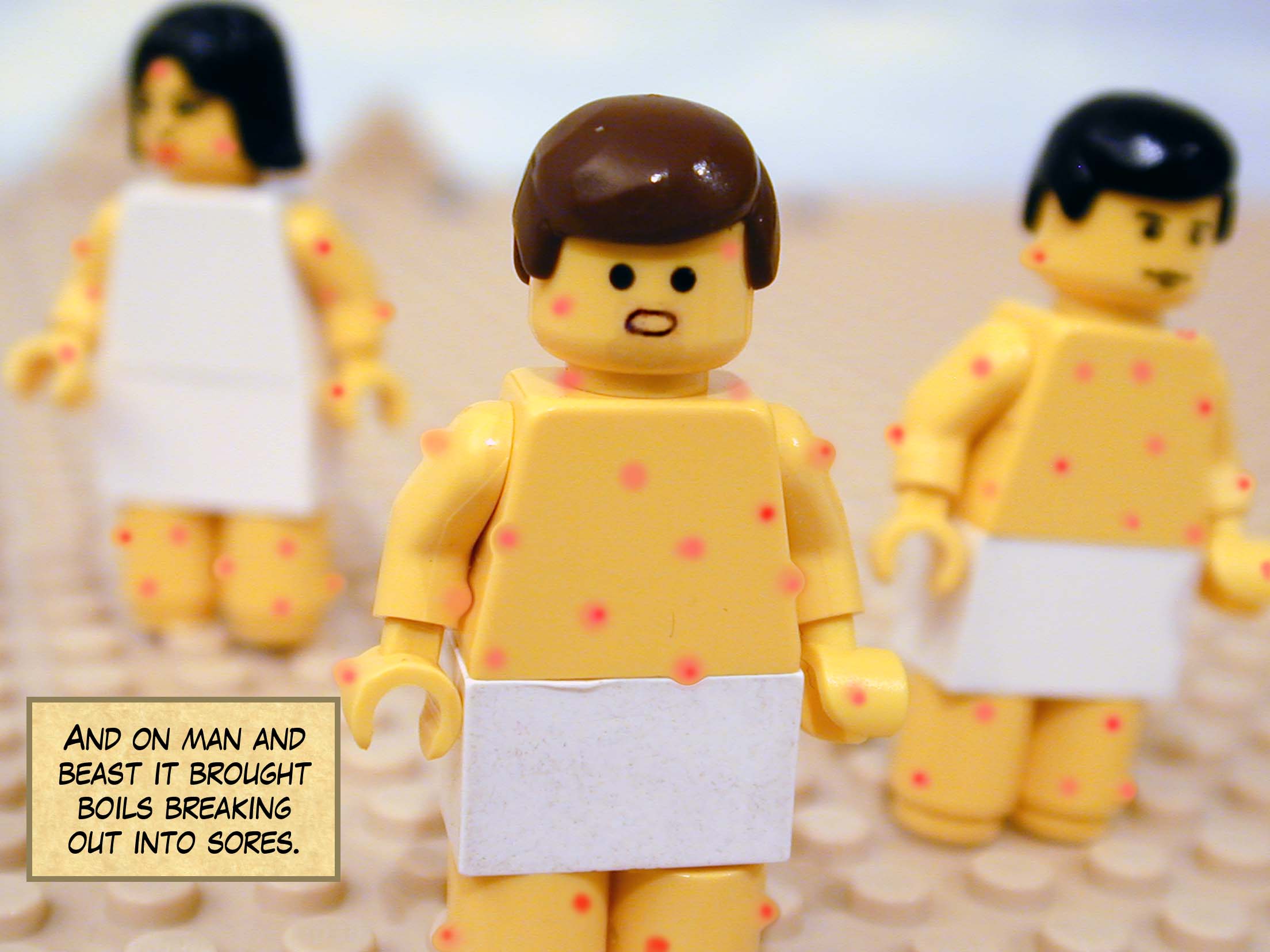 And on man and beast it brought boils breaking out into sores.