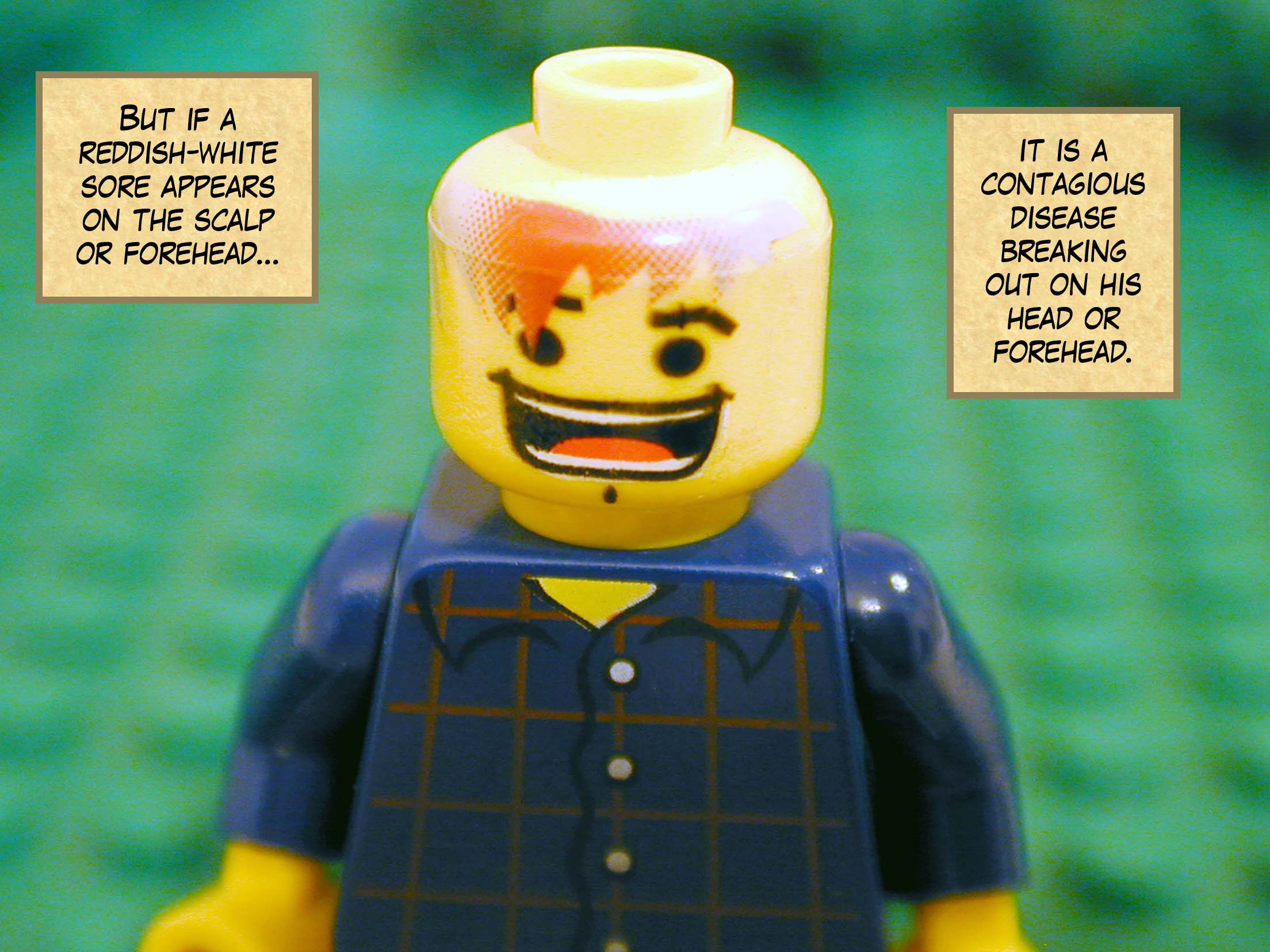 'But if a reddish-white sore appears on the scalp or forehead, it is a contagious disease breaking out on his head or forehead.'